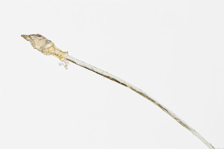 What Is the White Bulb at The End of a Strand of Hair?