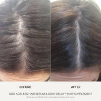 GRO AGELESS Anti-Gray Hair Serum (3 Pack)