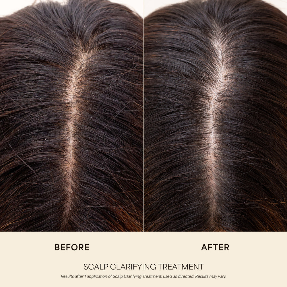 Scalp Clarifying Treatment