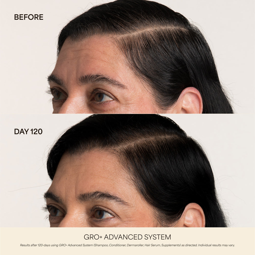 GRO+ Advanced Dermaroller