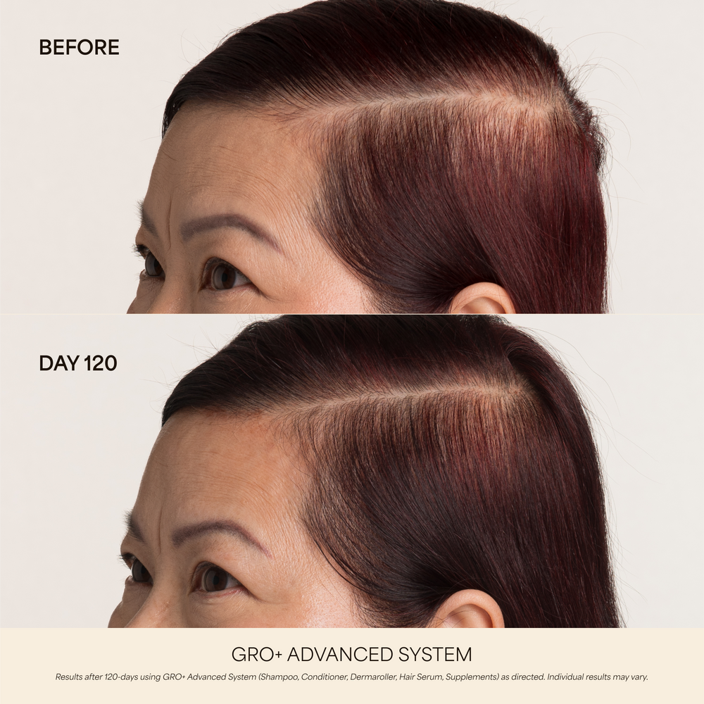 GRO+ Advanced Essentials Kit