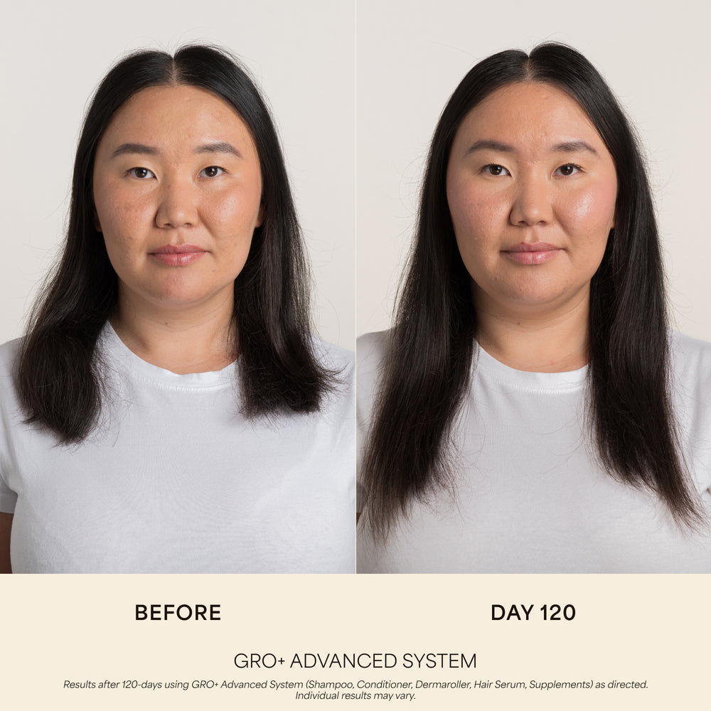 GRO+ Advanced Hair Growth & Density Supplements