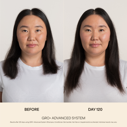 Hair Growth & Longevity Kit