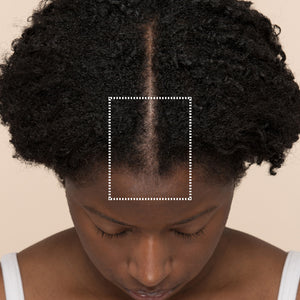 GRO+ Advanced Hair Serum Before