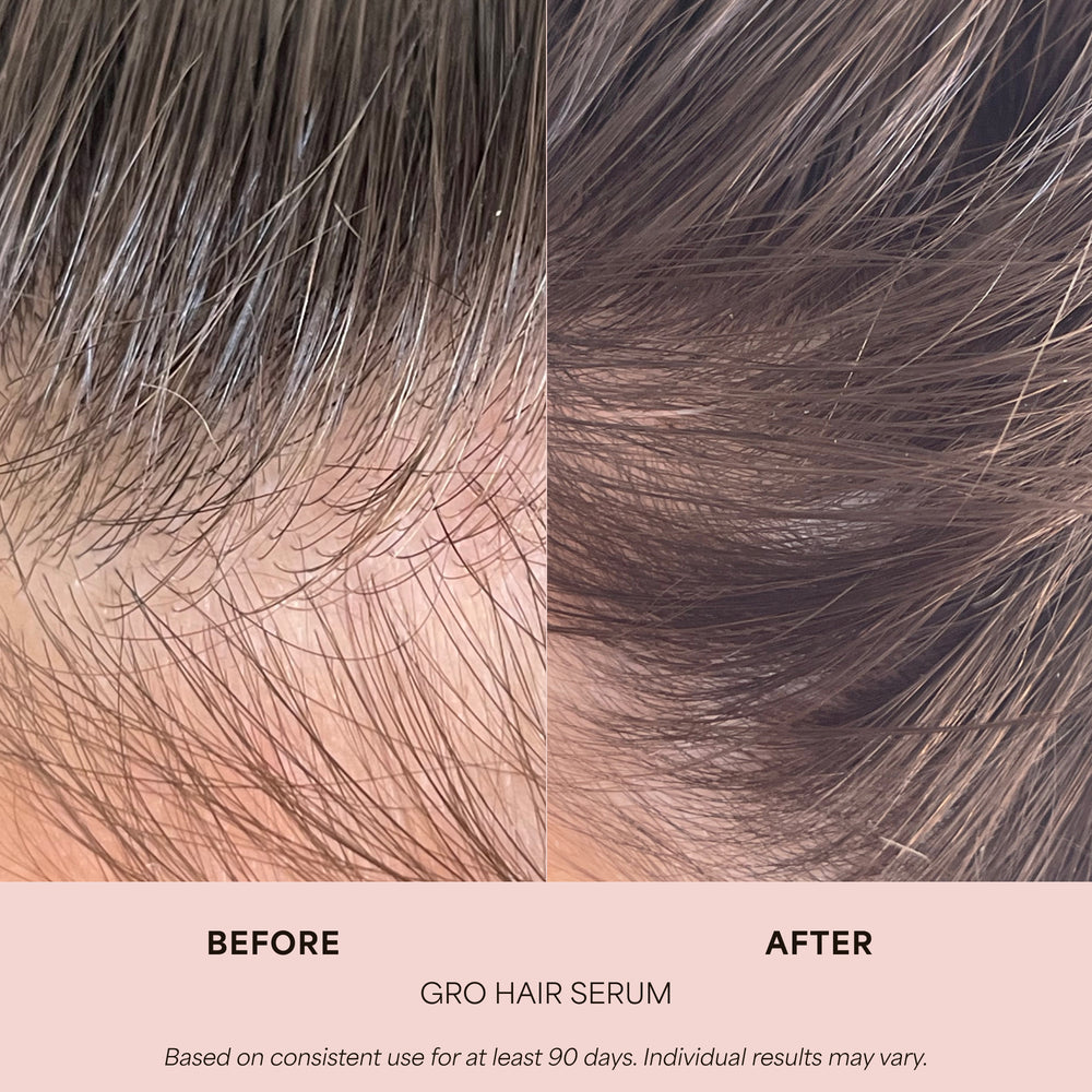 GRO Hair Serum