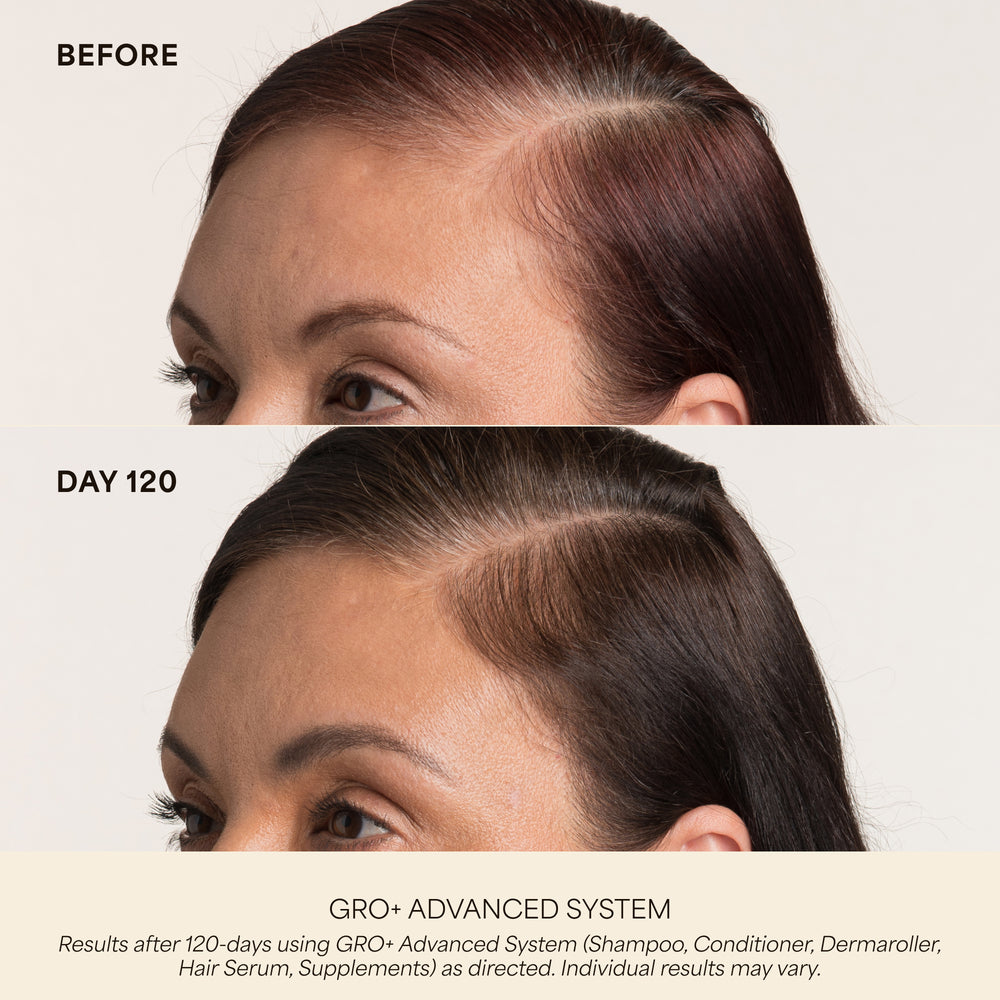 GRO+ Advanced Hair Serum