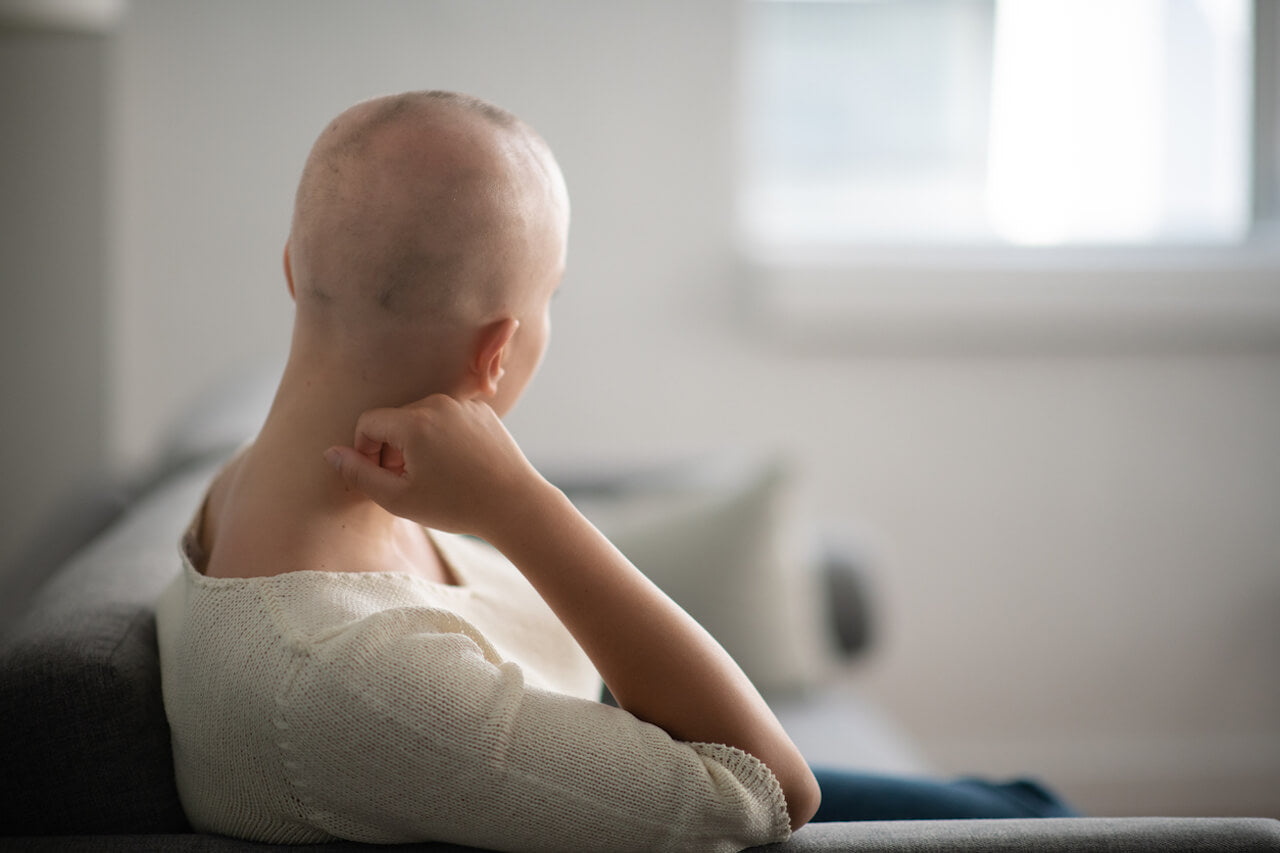 Alopecia universalis