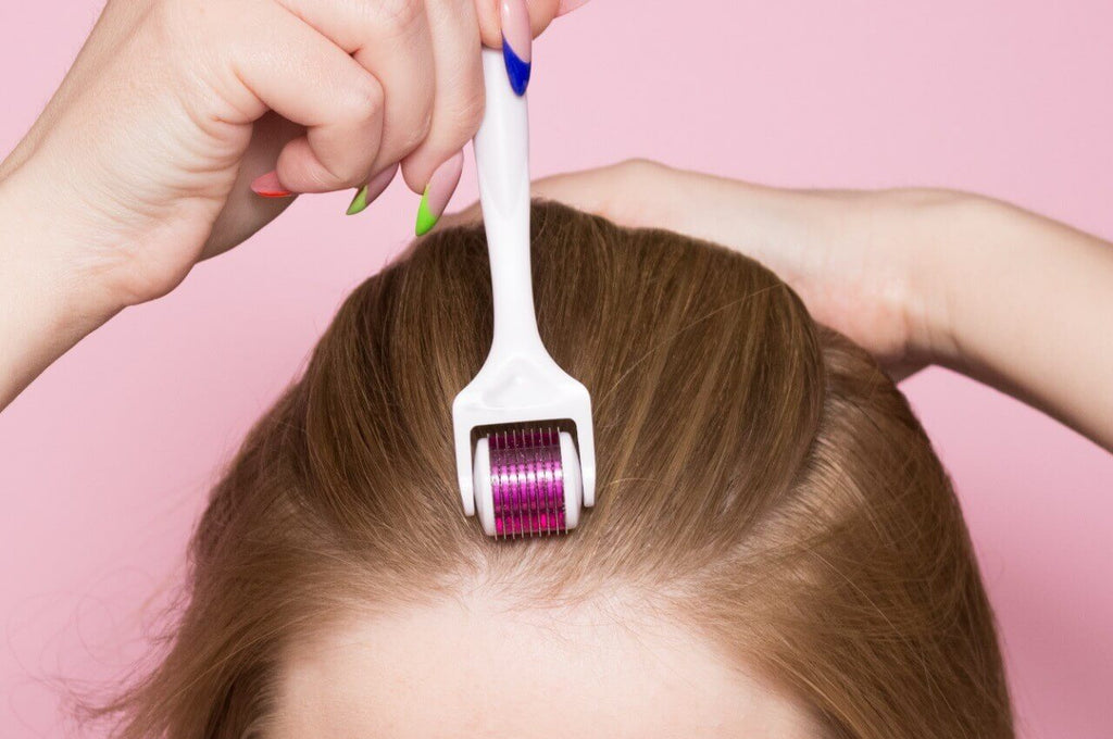 What is Microneedling for Hair Loss?  