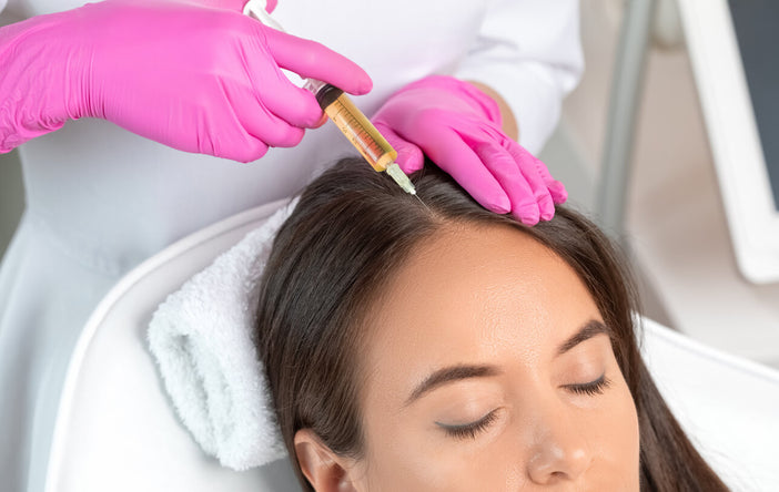 What You Should Know About PRP for Hair Loss