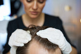 Dermatologist examining hair loss