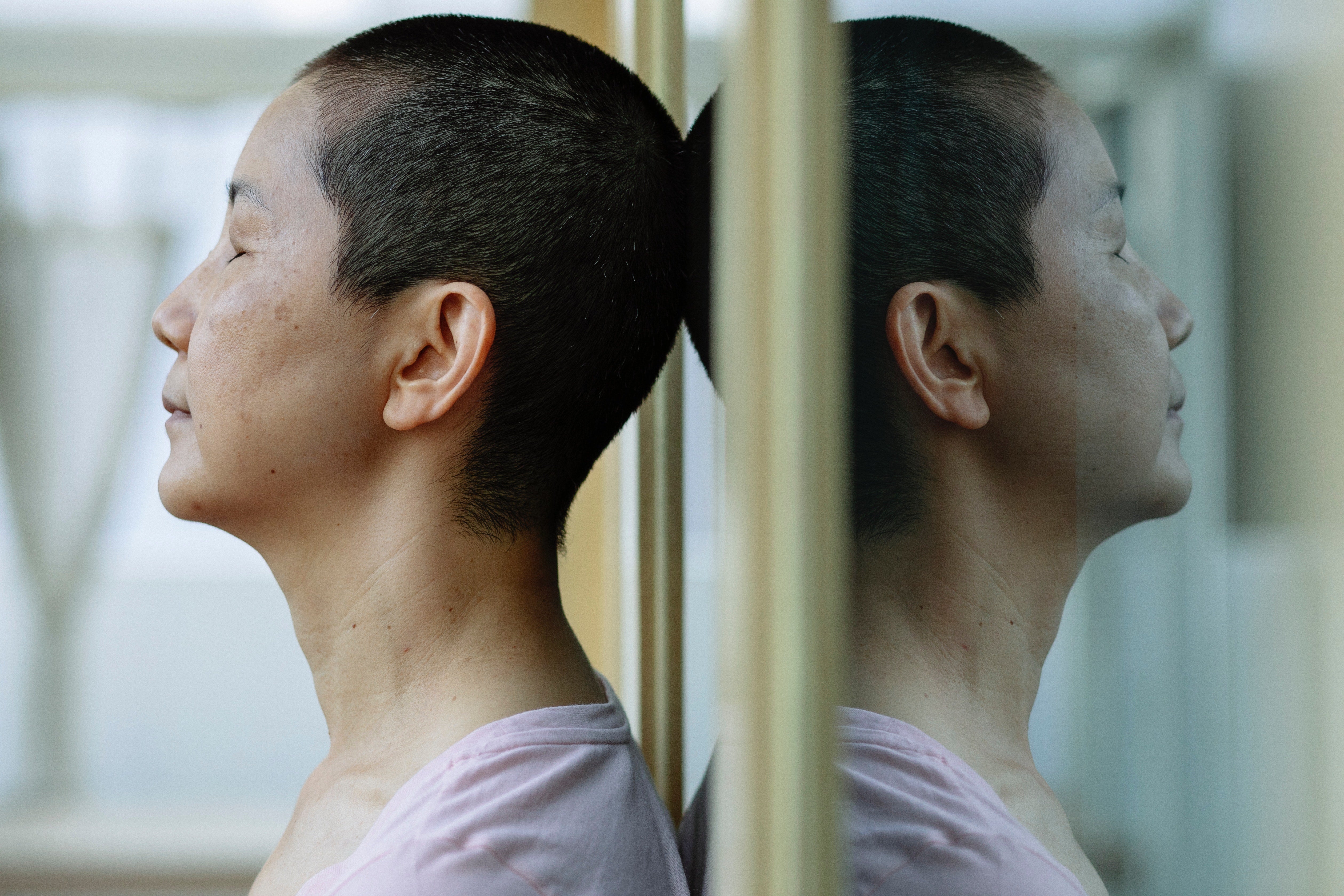 Cancer & Hair Loss — What to Expect
