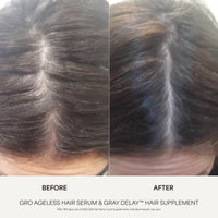 GRO AGELESS Anti-Gray Hair Serum (3 Pack)