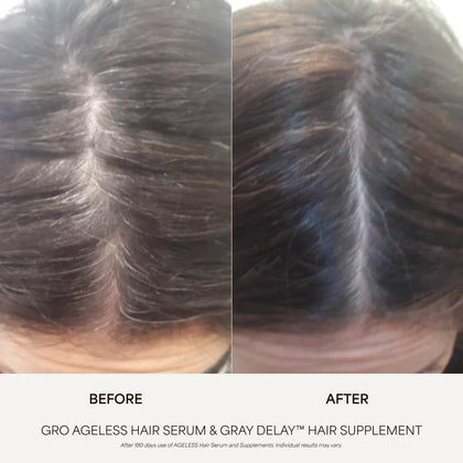 GRO AGELESS Anti-Gray Hair Serum (3 Pack)
