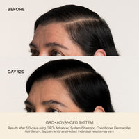 GRO+ Advanced Gel-Serum Pen