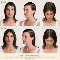 GRO+ Advanced Hair Growth & Density Supplements