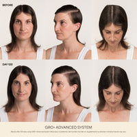 GRO+ Advanced Hair Growth & Density Supplements