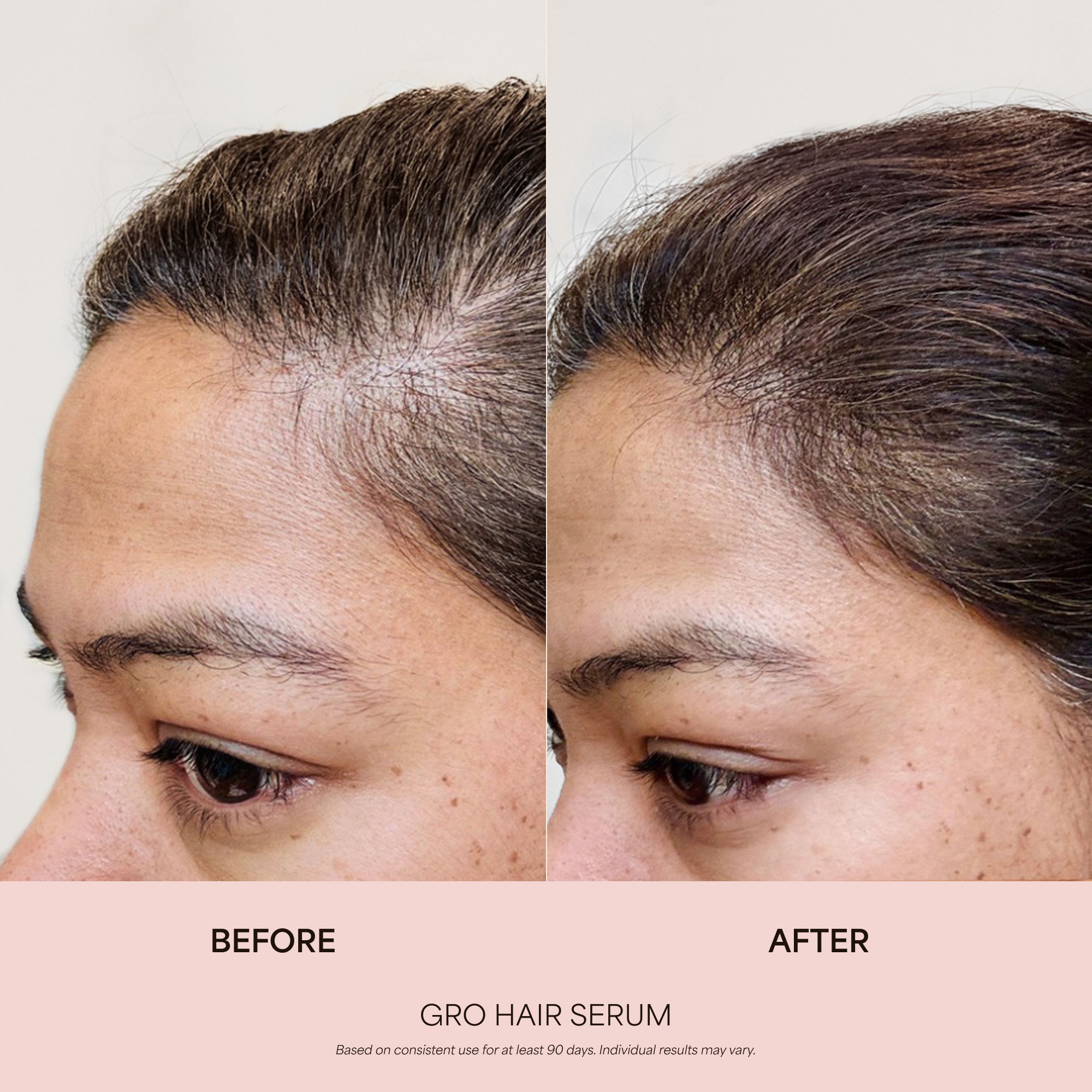 360° Hair Reboot System | Hair, Lash & Brows | VEGAMOUR