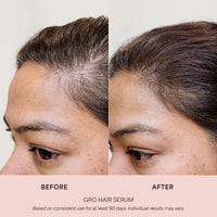 GRO Hair Serum