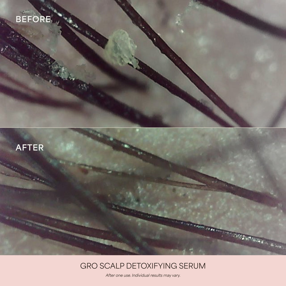 GRO Scalp Detoxifying Serum