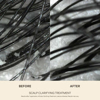 Scalp Clarifying Treatment