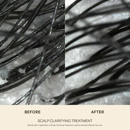 Scalp Clarifying Treatment