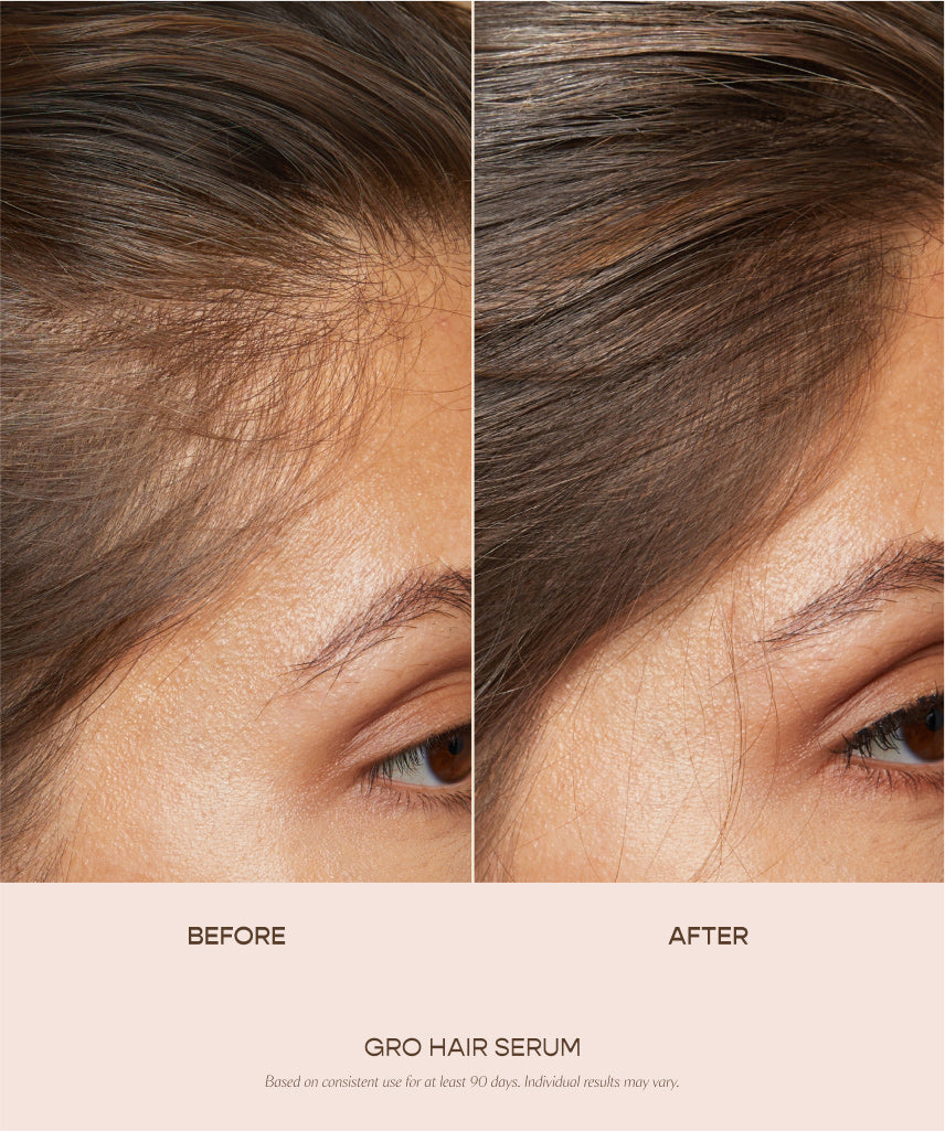 GRO Better Duo | Hair Serum & Scalp Massager | VEGAMOUR