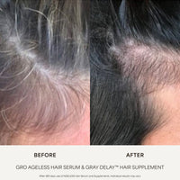 GRO AGELESS Anti-Gray Hair Serum (3 Pack)
