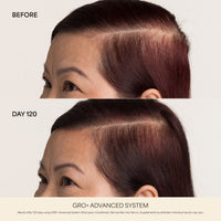 GRO+ Advanced Hair Growth & Density Supplements
