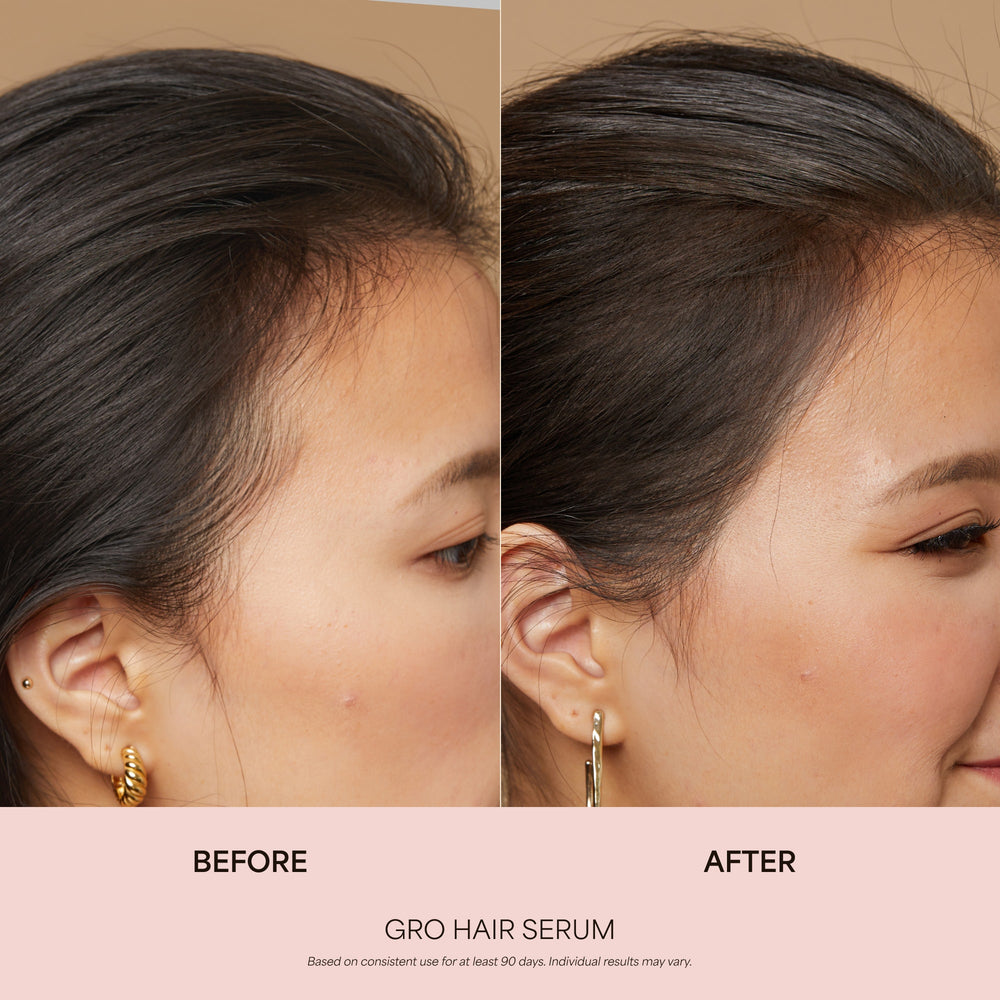 GRO Hair Serum