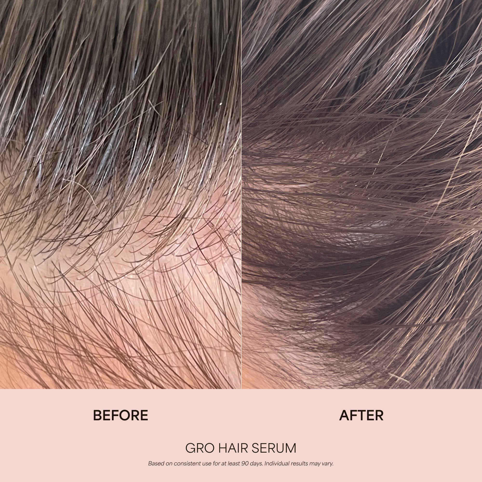 360° Hair Reboot System | Hair, Lash & Brows | VEGAMOUR