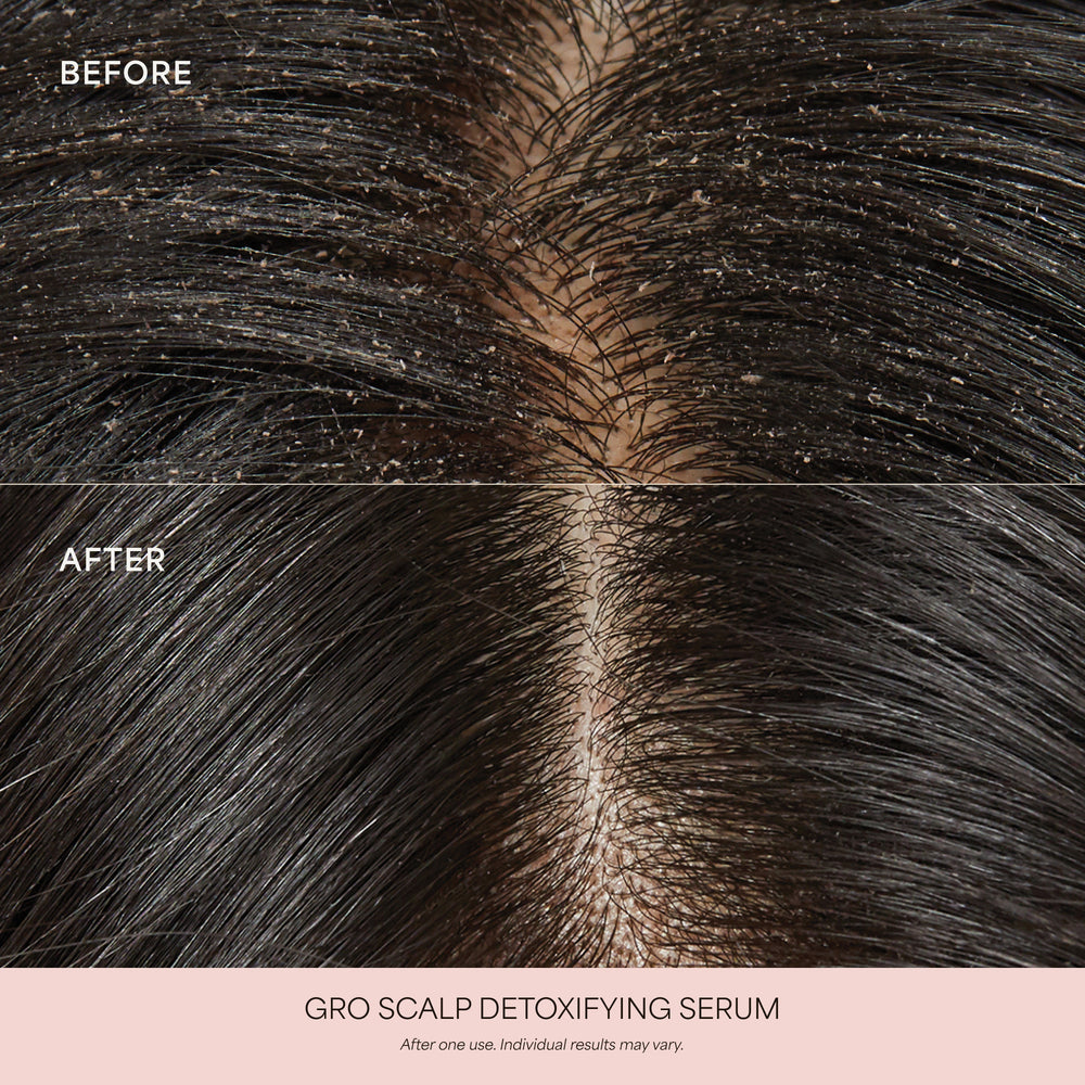 GRO Scalp Detoxifying Serum