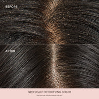 GRO Scalp Detoxifying Serum