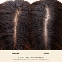 Scalp Clarifying Treatment