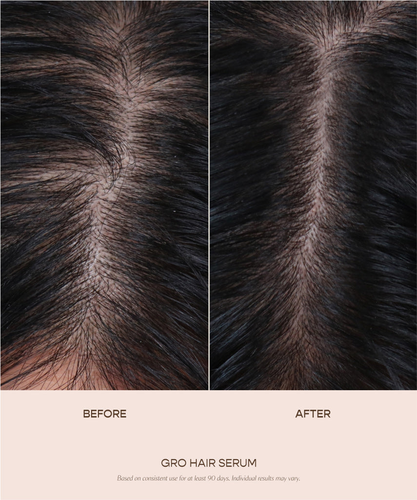 GRO Better Duo | Hair Serum & Scalp Massager | VEGAMOUR