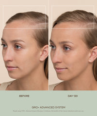 GRO+ Advanced Before & After