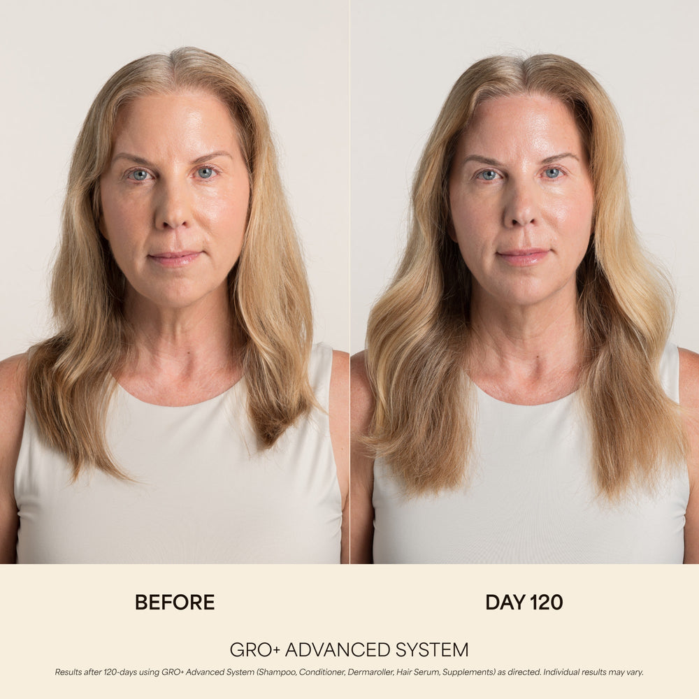 GRO+ Advanced Hair Growth & Density Supplements