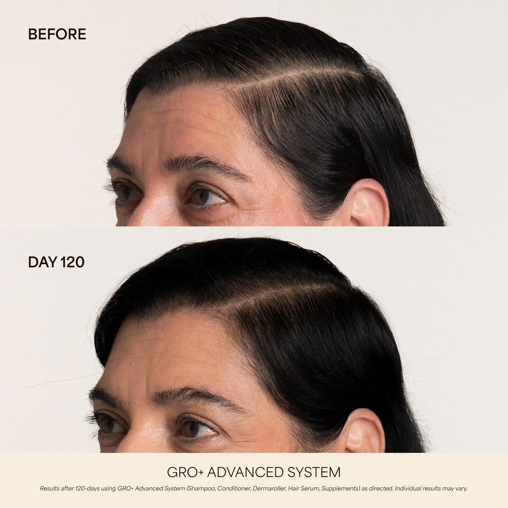 GRO+ Advanced Hair Growth & Density Supplements