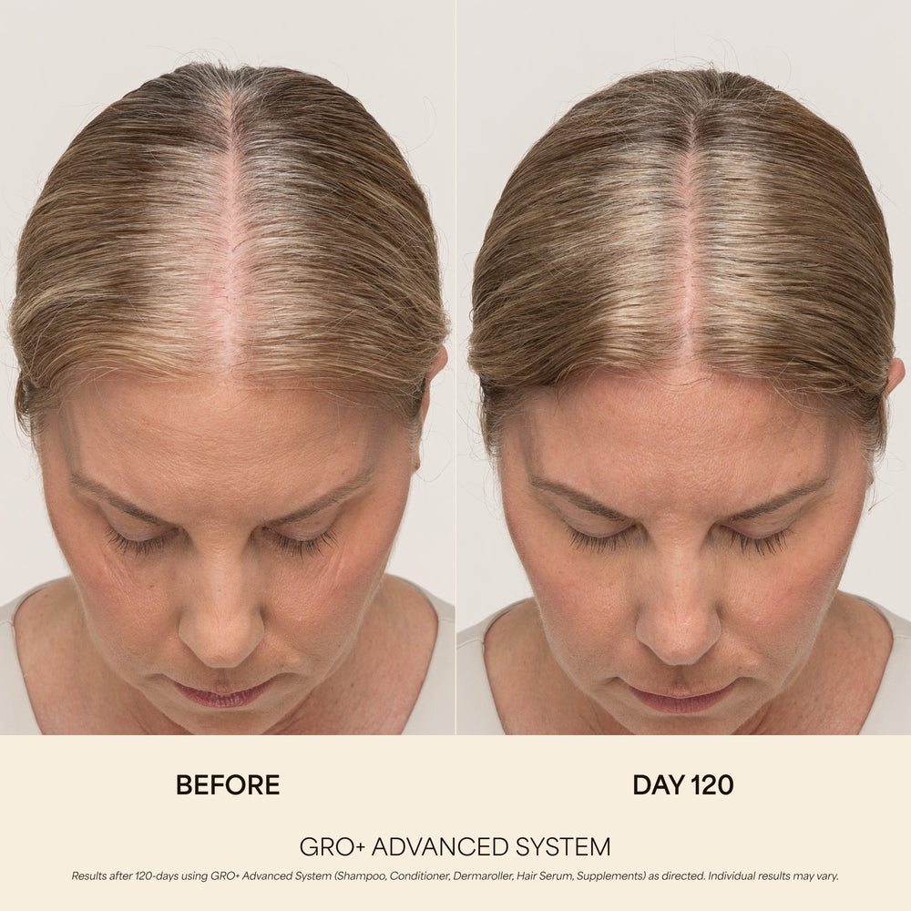 GRO+ Advanced Hair Serum