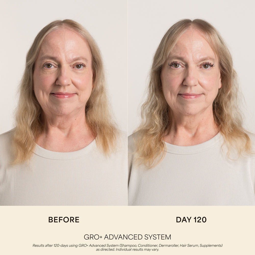 GRO+ Advanced Balancing Conditioner