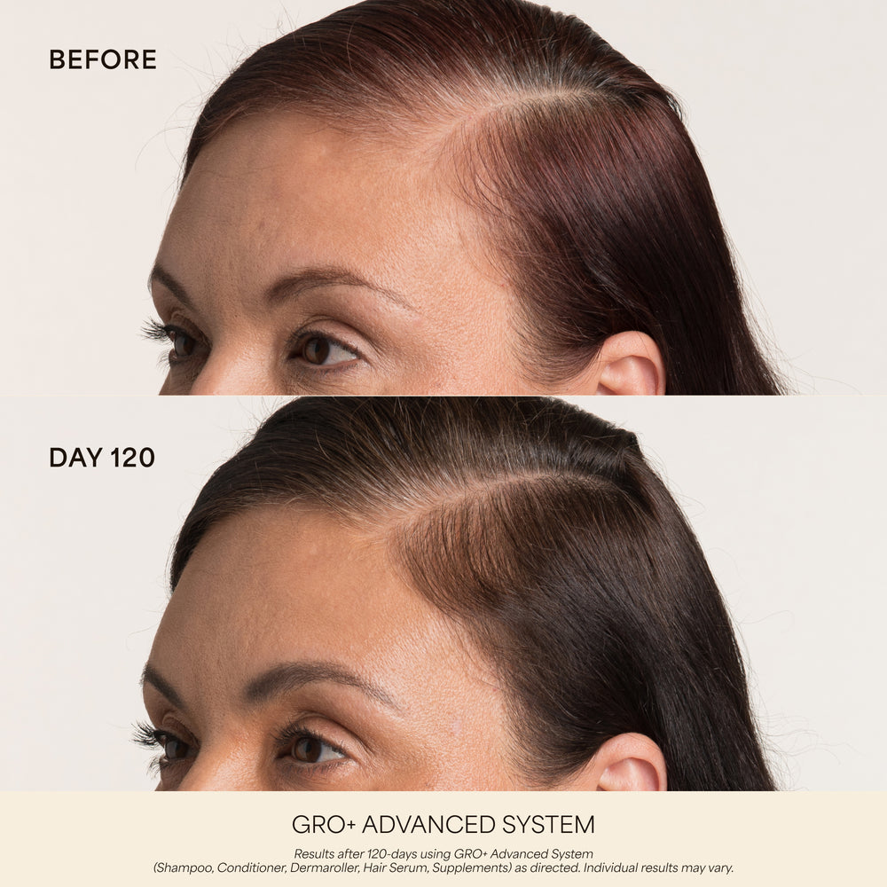 GRO+ Advanced Dermaroller