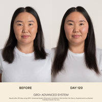 GRO+ Advanced Hair Growth & Density Supplements