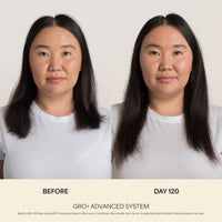 GRO+ Advanced Hair Growth & Density Supplements