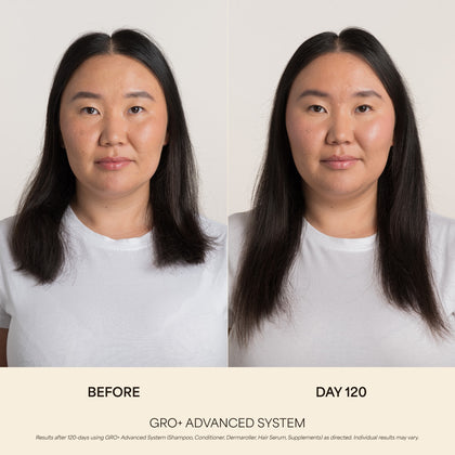 GRO+ Advanced Hair Growth & Density Supplements