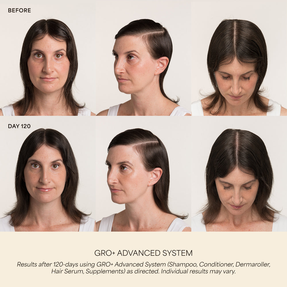 GRO+ Advanced Gel-Serum Pen