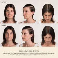 GRO+ Advanced Gel-Serum Pen