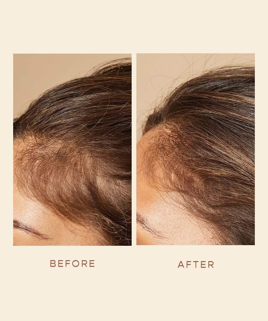 GRO Hair Foam - Before & After