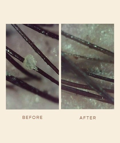 GRO Scalp Detoxifying Serum Before and After
