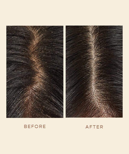 GRO Scalp Detoxifying Serum Before and After