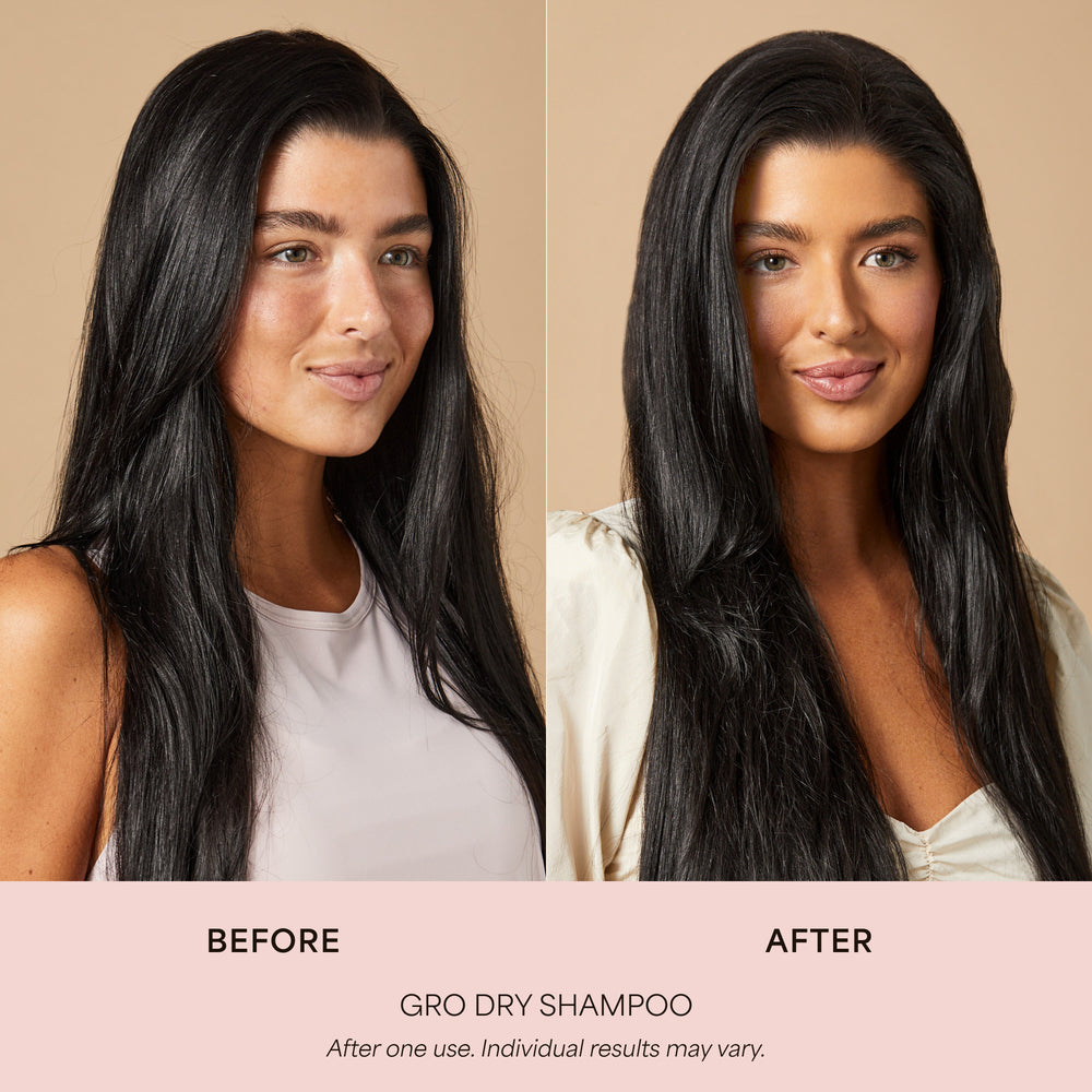 GRO Dry Shampoo