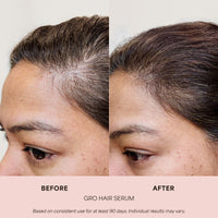 GRO Hair Serum